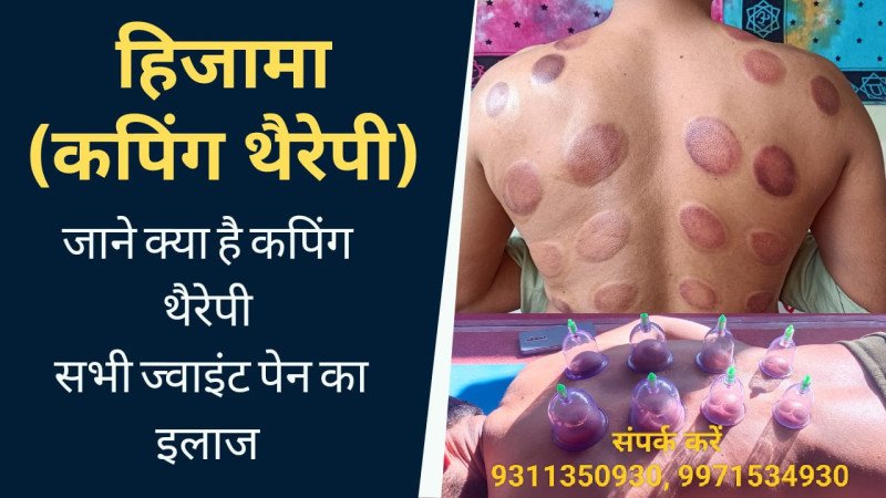 Hijama & Cupping Therapy